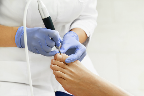 Medische pedicure behandeling voetproblemen Averbode Scherpenheuvel