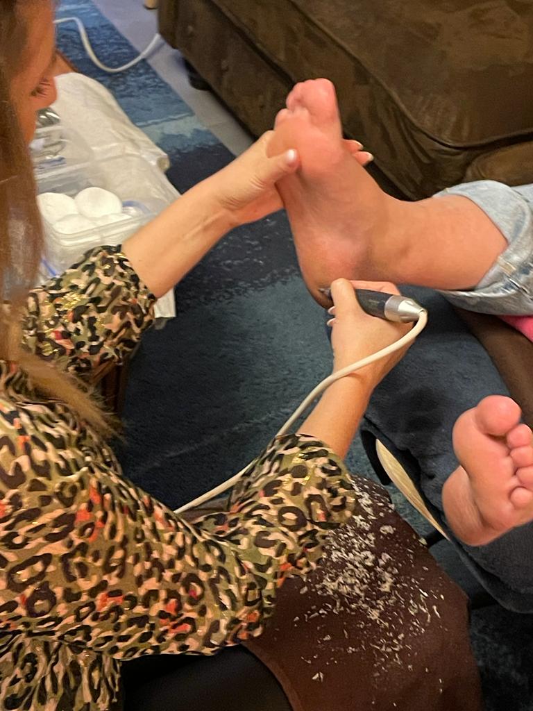 Eelt verwijderen medische pedicure Scherpenheuvel Averbode